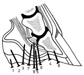 Bez kopyt není koně: 12.díl - Kopytní absces
