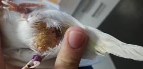 Lipom